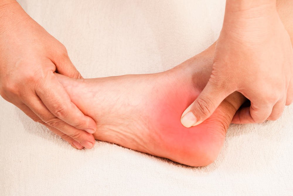 Gai gót chân và cách điều trị hiệu quả