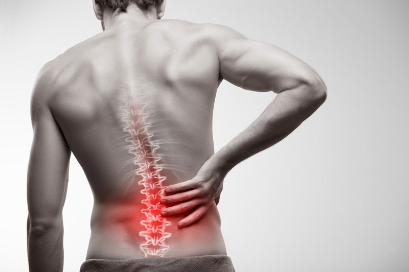 BIẾN CHỨNG NGUY HIỂM CỦA THOÁT VỊ ĐĨA ĐỆM CỘT SỐNG THẮT LƯNG