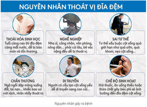 Thoát vị đĩa đệm chữa như thế nào, Sóng Radio Cao Tần hỗ trợ điều trị bệnh an toàn, hiệu quả